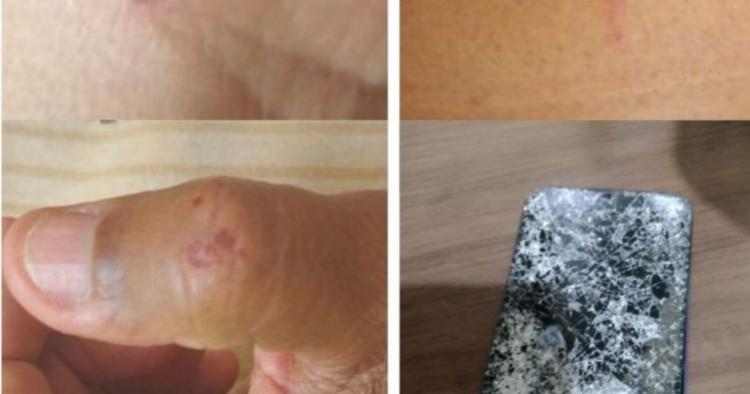 Jornalista é agredido e tem celular destruído ao filmar guerra de espadas em Cruz das Almas