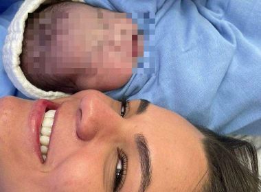 Bebê nasce empelicado e vídeo de médico rompendo bolsa viraliza; assista