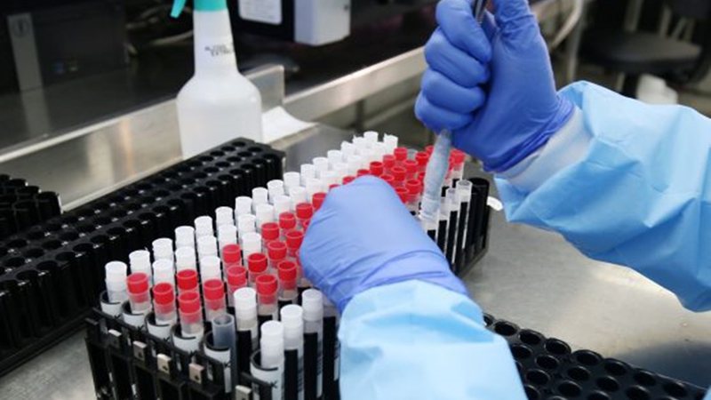 Reforço da Pfizer após Coronavac eleva eficácia contra a Covid em 92,7%, diz estudo