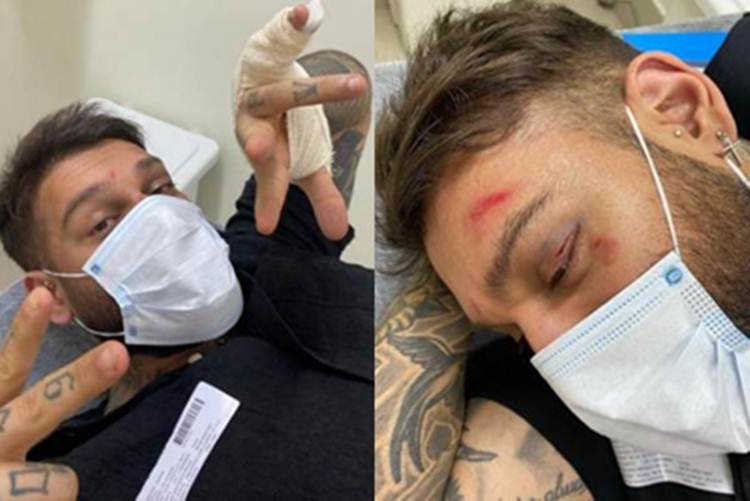 Cantor Lucas Lucco sofre acidente doméstico e vai parar no hospital