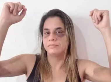 Alagoinhas: Empresária denuncia ex por agressões que duraram quase 2 anos
